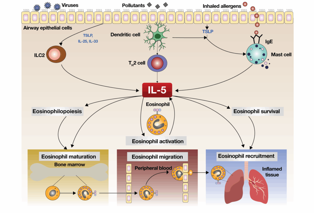 High Eosinophil Levels in Asthma